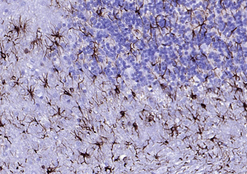 GFAP Recombinant Rabbit Monoclonal Antibody