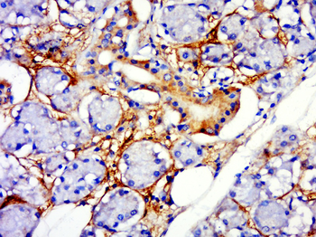TSHR (CT) Rabbit Polyclonal Antibody
