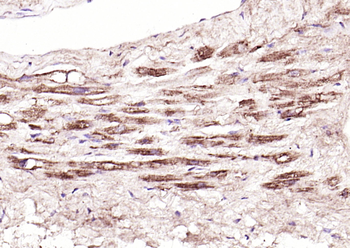 TSLP Rabbit Polyclonal Antibody