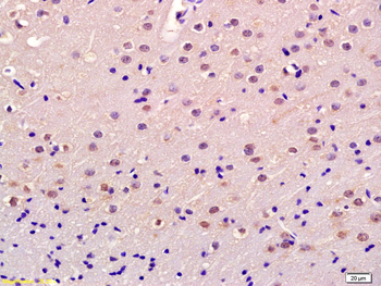 TTF1/NKX2-1 Rabbit Polyclonal Antibody