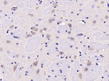 Tyrosine Hydroxylase Rabbit Polyclonal Antibody