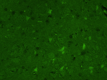 Tyrosine Hydroxylase Rabbit Polyclonal Antibody