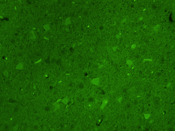 Tyrosine Hydroxylase Rabbit Polyclonal Antibody