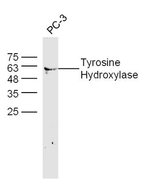 Tyrosine Hydroxylase Rabbit Polyclonal Antibody