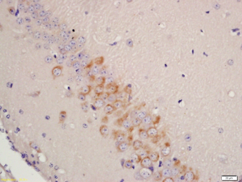 Tyrosine Hydroxylase Rabbit Polyclonal Antibody