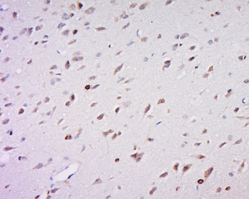Tyrosinase Rabbit Polyclonal Antibody
