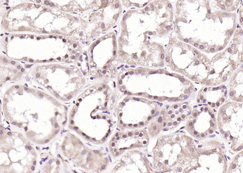 VHL Rabbit Polyclonal Antibody