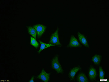 Ubiquitin Rabbit Polyclonal Antibody