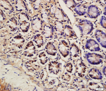 Ubiquitin Rabbit Polyclonal Antibody