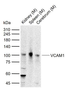 VCAM1 Rabbit Polyclonal Antibody