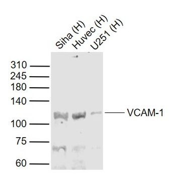 VCAM1 Rabbit Polyclonal Antibody