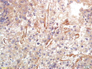 VCAM1 Rabbit Polyclonal Antibody