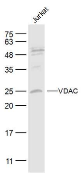 VDAC Rabbit Polyclonal Antibody
