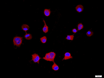 VEGFR1 Rabbit Polyclonal Antibody