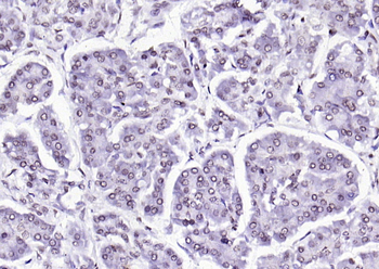 VEGFR3 Rabbit Polyclonal Antibody