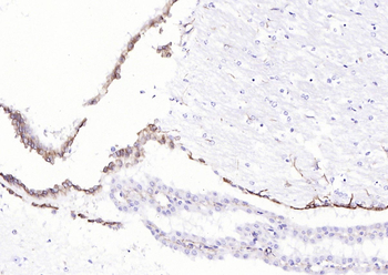 Vimentin Rabbit Polyclonal Antibody