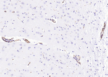 Vimentin Rabbit Polyclonal Antibody