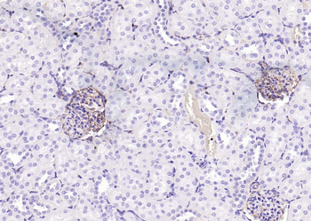 Vimentin Rabbit Polyclonal Antibody