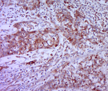 Vimentin Rabbit Polyclonal Antibody