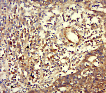 Vimentin Rabbit Polyclonal Antibody