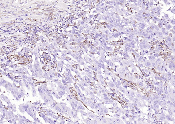 Vimentin Rabbit Polyclonal Antibody