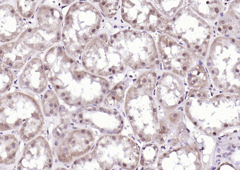 Visfatin Rabbit Polyclonal Antibody