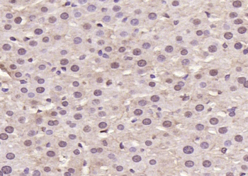 Visfatin Rabbit Polyclonal Antibody