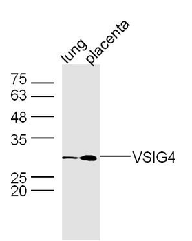 VSIG4 Rabbit Polyclonal Antibody