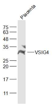 VSIG4 Rabbit Polyclonal Antibody