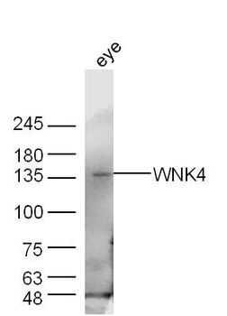 WNK4 Rabbit Polyclonal Antibody
