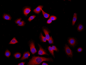 WDR26 Rabbit Polyclonal Antibody