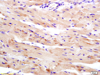 WDR26 Rabbit Polyclonal Antibody