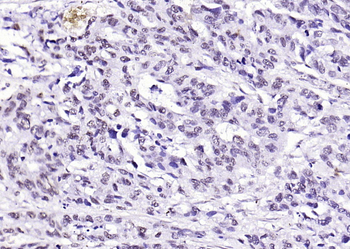 WWOX Rabbit Polyclonal Antibody