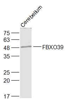 XAF1 Rabbit Polyclonal Antibody