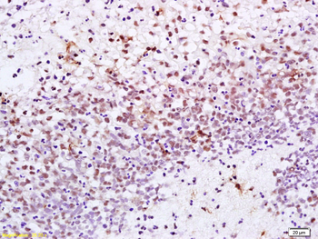 XRCC1 Rabbit Polyclonal Antibody