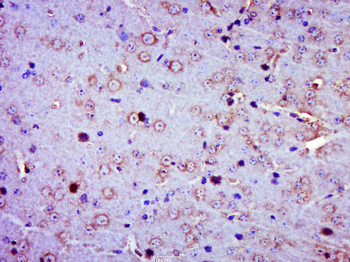 Phospho-Calmodulin 1/2/3 (Ser102) Rabbit Polyclonal Antibody