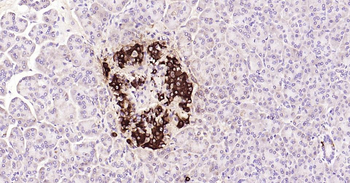 Insulin Recombinant Rabbit Monoclonal Antibody