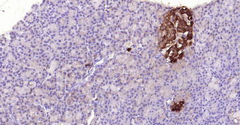 Insulin Recombinant Rabbit Monoclonal Antibody