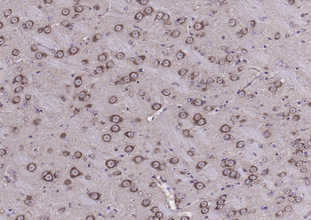 Adenosine A3 Receptor Rabbit Polyclonal Antibody
