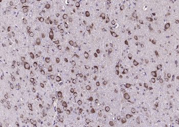 Adenosine A3 Receptor Rabbit Polyclonal Antibody