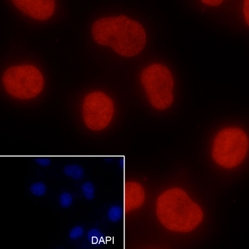 Mono-Methyl-Histone H3 (Lys56) Rabbit Polyclonal Antibody