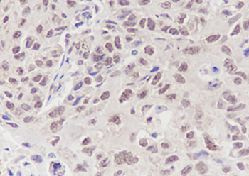 RBBP4 Recombinant Rabbit Monoclonal Antibody