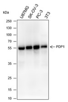PDP1 Recombinant Rabbit Monoclonal Antibody
