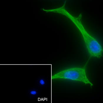PDP1 Recombinant Rabbit Monoclonal Antibody
