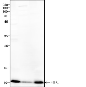 DYNLL1 Recombinant Rabbit Monoclonal Antibody