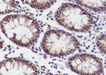 DYNLL1 Recombinant Rabbit Monoclonal Antibody