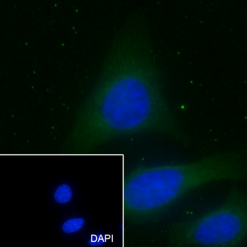 STOML2 Recombinant Mouse Monoclonal Antibody