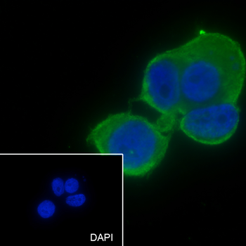 WNT2 Recombinant Mouse Monoclonal Antibody