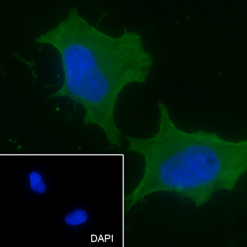 PCK2 Recombinant Rabbit Monoclonal Antibody