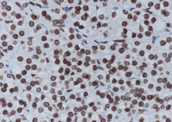 Di/Tri-Methyl-Histone H4 (Lys20) Recombinant Mouse Monoclonal Antibody